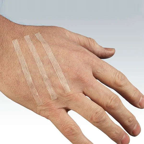 Sterostrip Sutures
